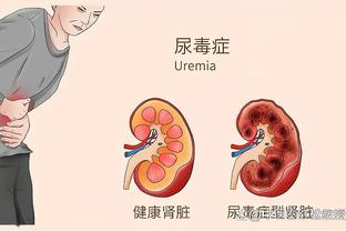 浓眉试图封盖90度崴脚 已经离场回更衣室